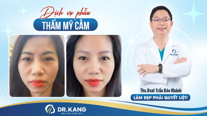 Thẩm mỹ cằm